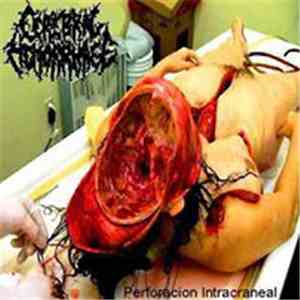 Cerebral Hemorrhage  - Perforacion Intracranea album flac