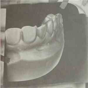 Lorn  - Ghosst(s) album flac