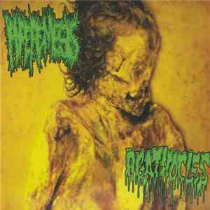 Hyperemesis / Agathocles - Hyperemesis / Agathocles album flac