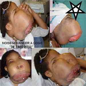 Noisegekanker A Gogo - The Tumor Ritual album flac
