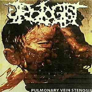 Urologist - Pulmonary Vein Stenosis album flac