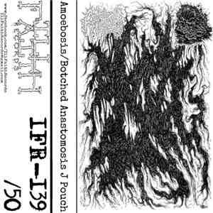 Amoebosis / Botched Anastomosis J-Pouch - Amoebosis / Botched Anastomosis J-Pouch album flac